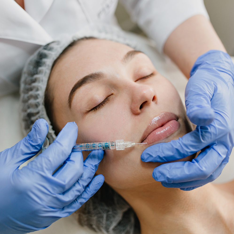 Injection d’acide hyaluronique dans les lèvres